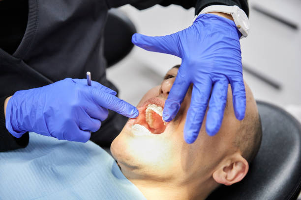 Best Emergency Dentist for Lost Fillings or Crowns in Elberta, AL